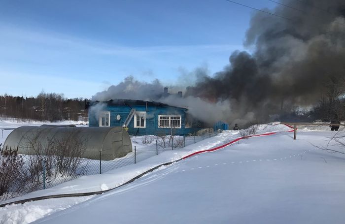 Вологжанку госпитализировали с ожогами в больницу из загоревшегося дома